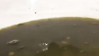 Shaved girl with heavy diarheea