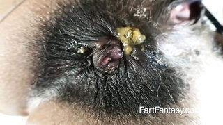 Very hairy beauty pooping