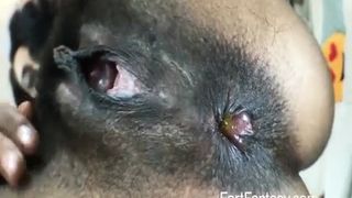 Hairy black girl farting loud