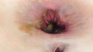 Shitting after masturbating