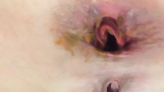 Shitting after she pulled out a dildo