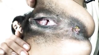 Black girl shitting in close up