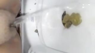 Shitting and peeing