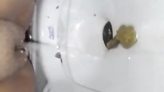 Shitting and peeing