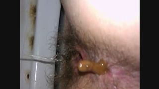 wife has soft dhiarria and poops