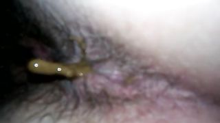 wife has soft dhiarria and poops