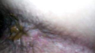 wife has soft dhiarria and poops