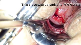 sleeping period porn fuck speculum on her period