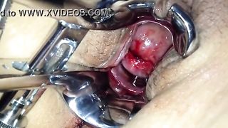 sleeping period porn fuck speculum on her period