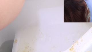 Diarheea with pressure