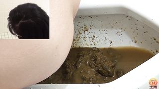 Pulled tight skirt up