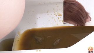 Diarrhea with pressure