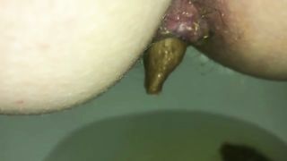 Big turd stuck