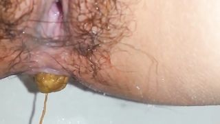 Close up of hairy wife shitting