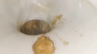 Hairy beauty shits in close up