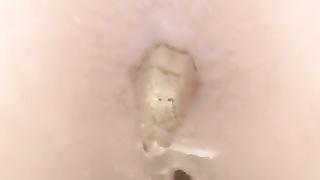 Brown shit over toilet