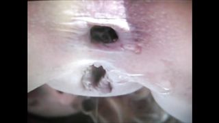 Woman shit and piss closeup