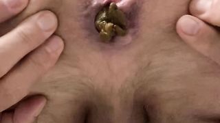 Gay guy stretches ass and shits