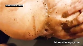 Guy pulls this Bitch apart to make her Shit then Anal Fucks her Hard After, Great.