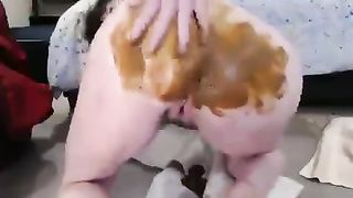 Amazing anal prolapse