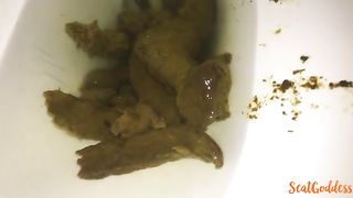 Hairy babe shitting a lot in close up