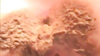 Real mess between butt cheeks from sexy teen