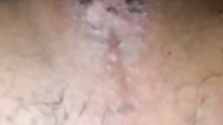 Girl with hairy ass takes a massive shit