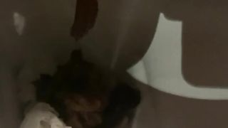 Shaved teen shitting lots