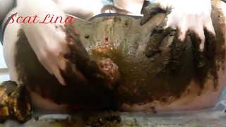 Real scat anal prolapse