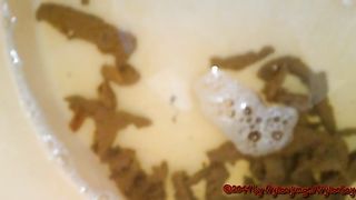 Poop tadpoles in the toilet