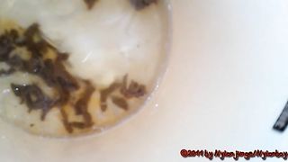 Poop tadpoles in the toilet