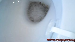 Poop tadpoles in the toilet