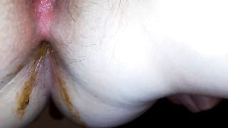 Massive poop from hot hairy teen