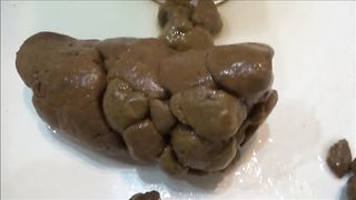 Teen drops hard poop into sink