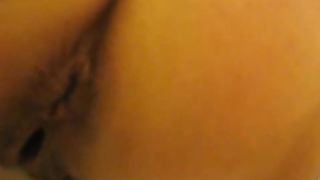 Liquid heavy poop in closeup