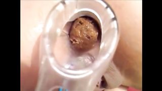 Speculum in her ass while shitting