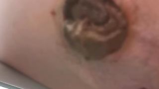 Hard shit gaping hole