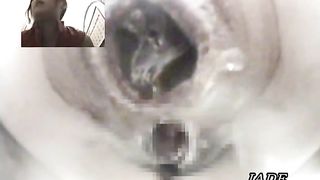 Dirty Pooping hole of Japanese lady