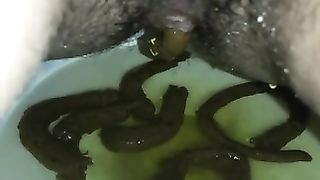 Dirty hairy ass pooping
