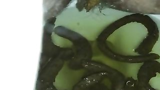 Dirty hairy ass pooping