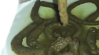 Dirty hairy ass pooping