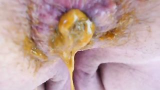 Yellow shit in hot closeup