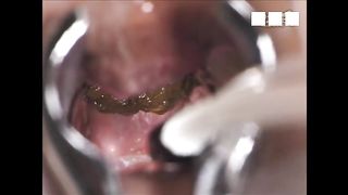 Closeup of nasty poop inside of asshole