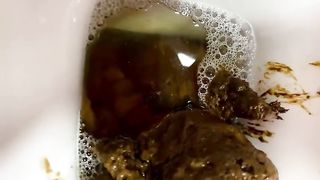 Hairy pussy milf pooping