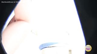 Messy diarrhea at friends place