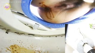 Messy diarrhea at friends place