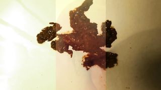 Menstrual poop closeup