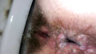 Messy sticky poop closeup