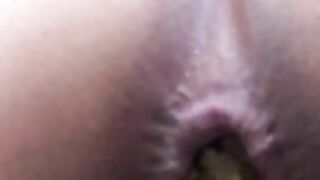 Yummy dark pooping asshole