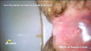 Hairy wet pussy leaking and pooping